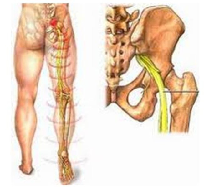 Cơ thể chúng ta có hơn 200 chiếc xương khác nhau. Một người bị mắc ung thư xương khi xuất hiện một khối u ác tính làm phá hủy các mô xương bình thường.